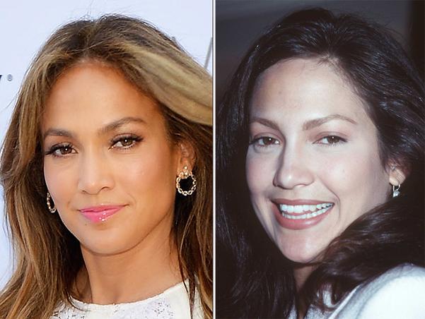 Cennifer Lopez və plastik cərrah arasında qalmaqal 