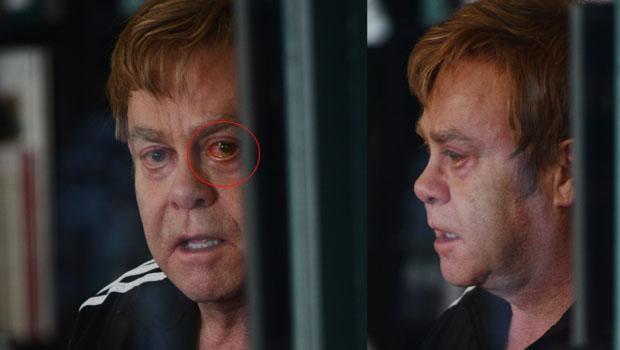 Elton Conun illər sonra eynəksiz şəkilləri yayıldı 