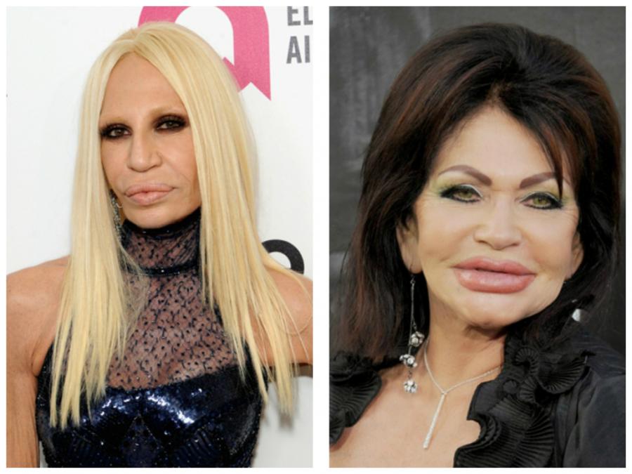 Hollivud məşhurlarının plastik əməliyyat faciəsi 