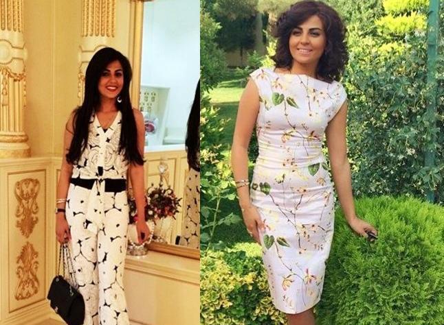 Gülay dəyişib belə oldu – foto