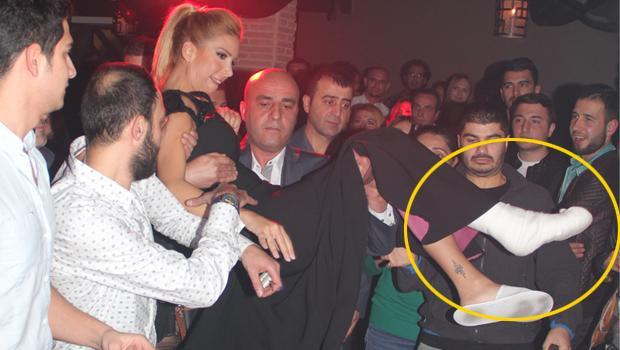 Səhnəyə ayağı sınmış halda çıxdı - fotolar
