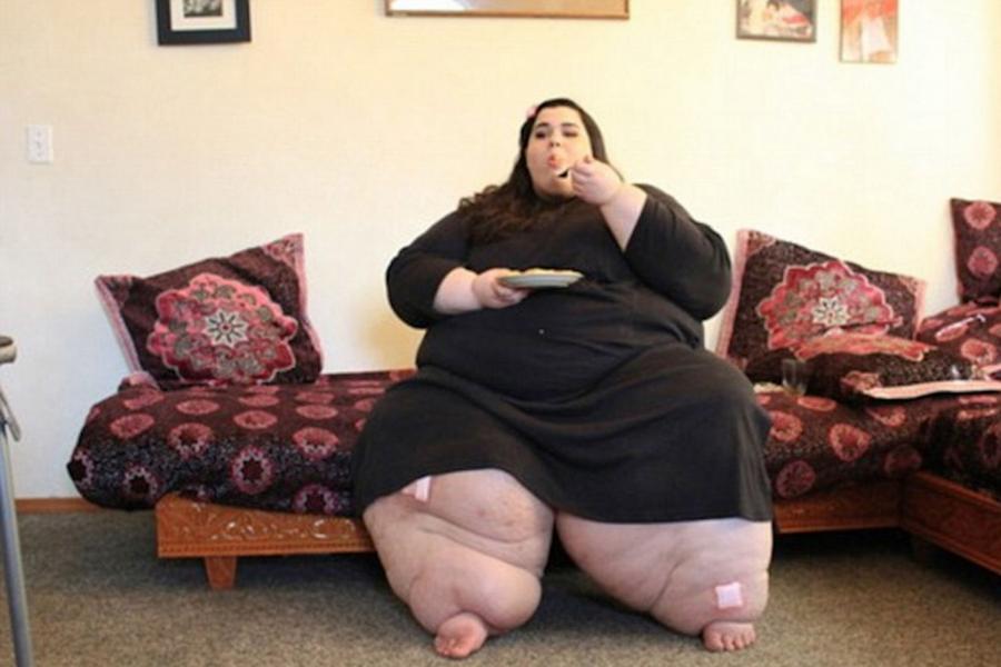Bu qızın 300 kiloqram çəkisi var - fotolar 