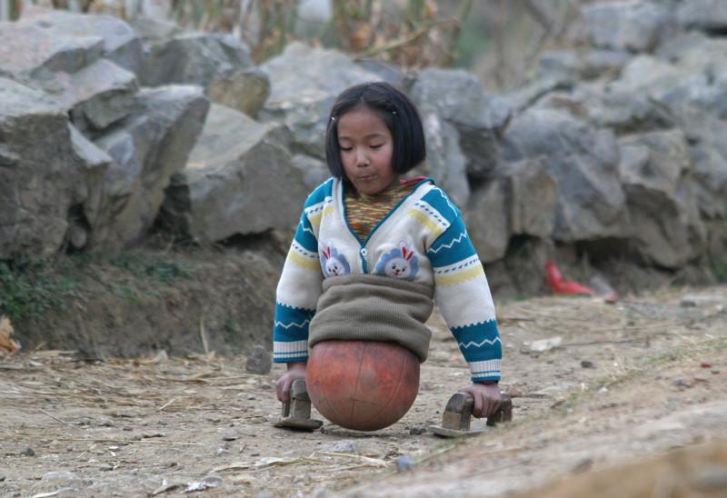 Ayaqları olmayan "basketbolçu qız" - fotolar