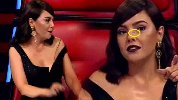 Ebru Gündeşin üzünə nə olub? - foto