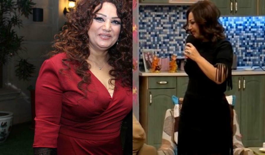 Azərbaycanlı müğənni plastik əməliyyatdan sonra belə oldu -  fotolar