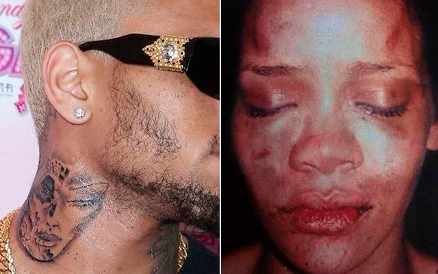 Rihannanı döyən müğənni yenə saxlanıldı - fotolar