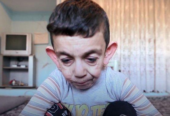7 yaşlı "qoca uşaq" görənləri heyrətləndirir - foto