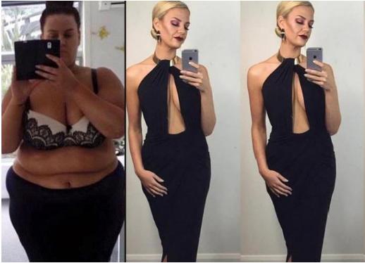 Bir ildə 90 kiloqram arıqlayıb belə oldu - fotolar