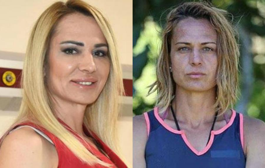 Görənlər tanımadı: sinəsini böyütdü, dodağına silikon vurdurdu - fotolar