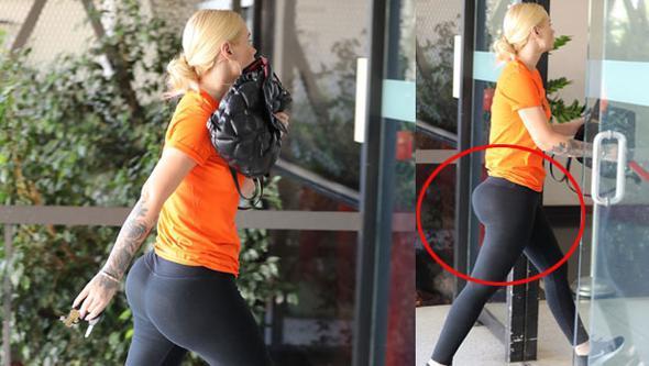 Müğənni ombasına plastik əməliyyat etdirdi - fotolar 