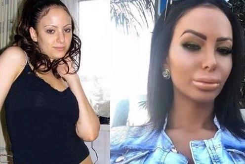 Anasına bənzəməmək üçün 200 əməliyyat keçirdi - fotolar