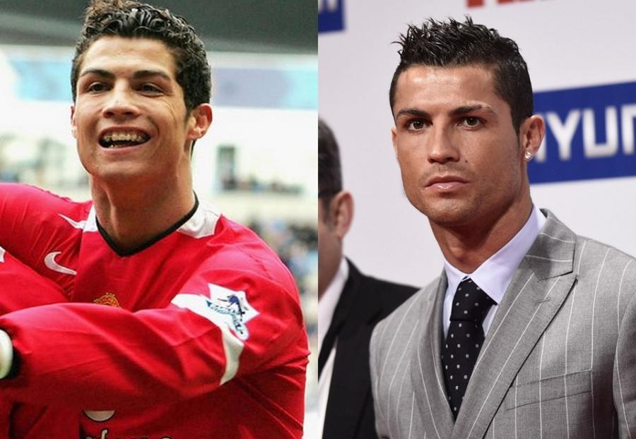 Ronaldo indiki görünüşü üçün, baxın, hansı əməliyyatlar keçirib - fotolar