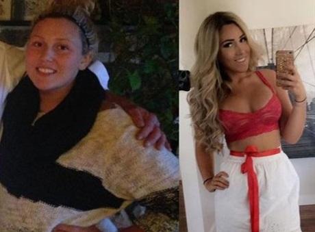 Qovuşmadığı sevgilisi üçün 40 kiloqram arıqladı - fotolar