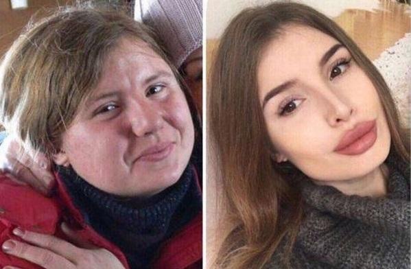 Arıqladıqdan sonra tanınmaz hala düşdülər - fotolar