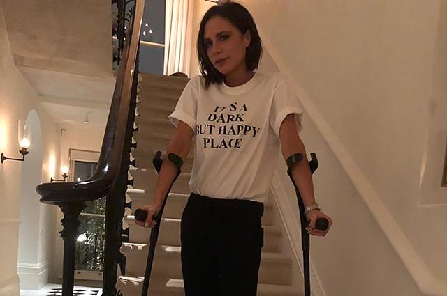 Viktoriya ayağını sındırdı -  foto