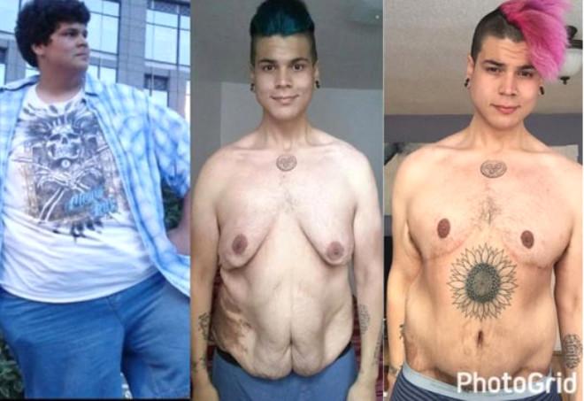 122 kiloqram arıqlayıb tanınmaz hala düşdü - fotolar