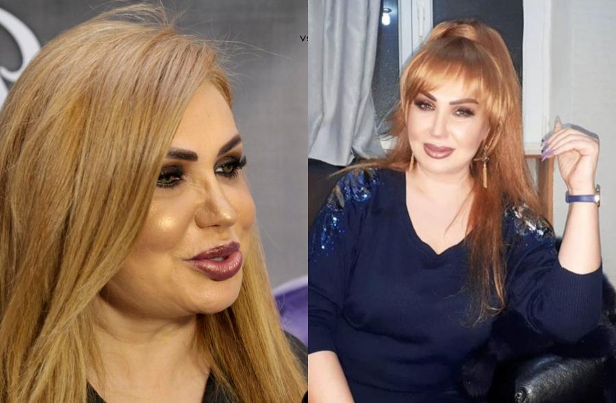 Könül Kərimovanın fotoşoplu və fotoşopsuz halı  