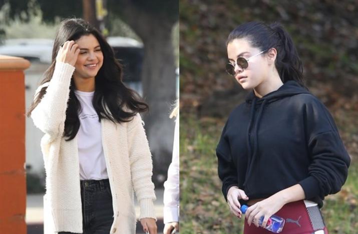 Selena Qomezin üzünə nə olub? - Fotolar