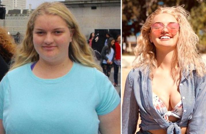 64 kiloqram arıqlayıb başqa biri oldu - Fotolar