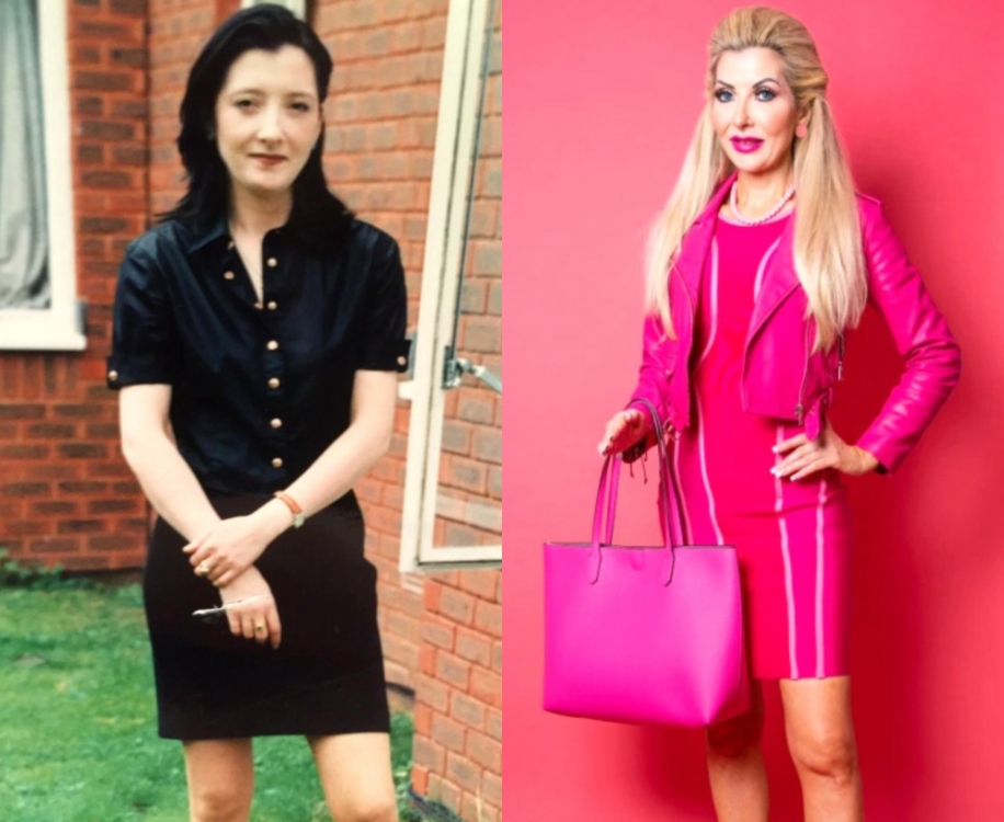 "Barbie" gəlinciyinə bənzəmək üçün sərvət xərclədi - Fotolar