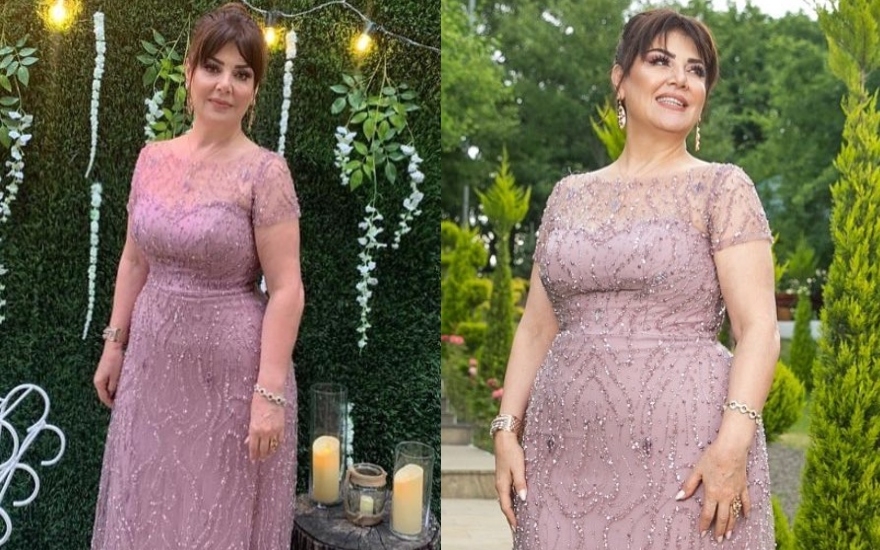 Eyni libasda həm kökdür, həm də arıq... - Fotolar