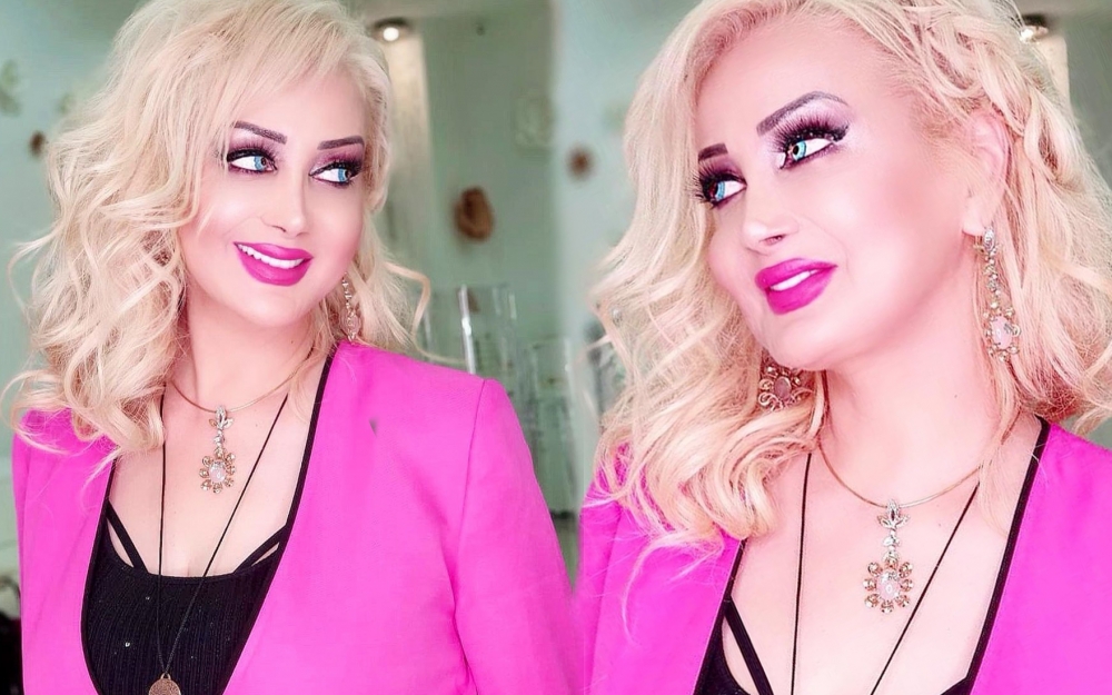 Bu dəfə gözlərini müzakirə etdilər - Fotolar