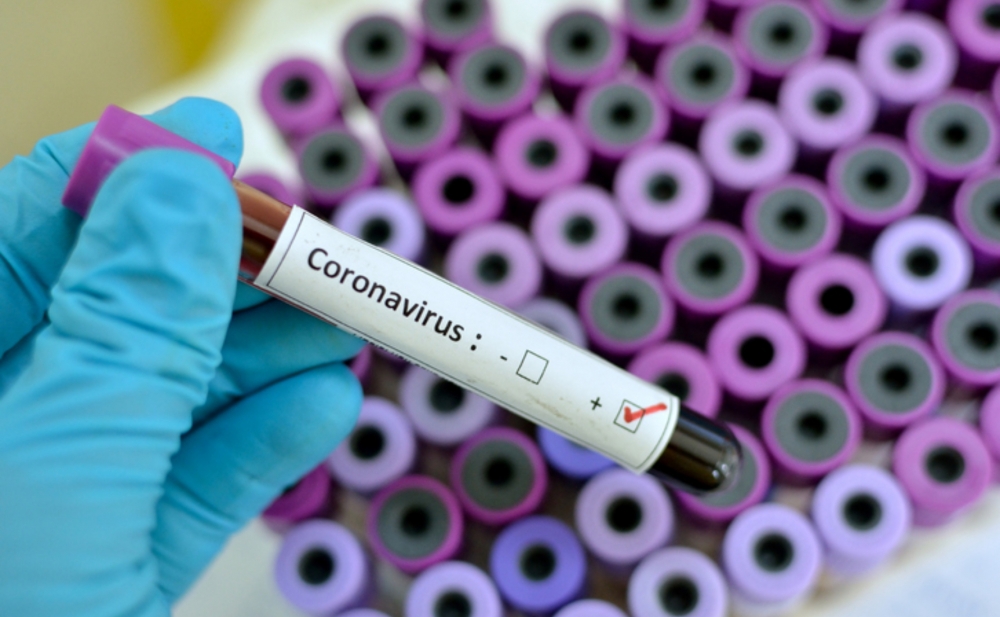 Azərbaycan koronavirusa görə 5 milyon ayırıb