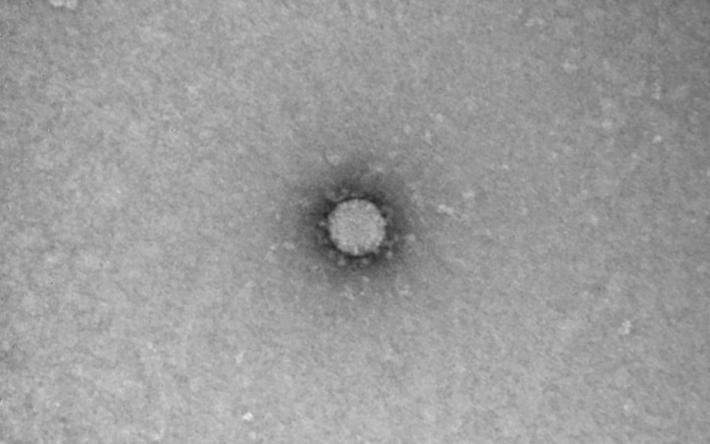 Saç telindən 400 dəfə incə olan koronavirus -  Foto