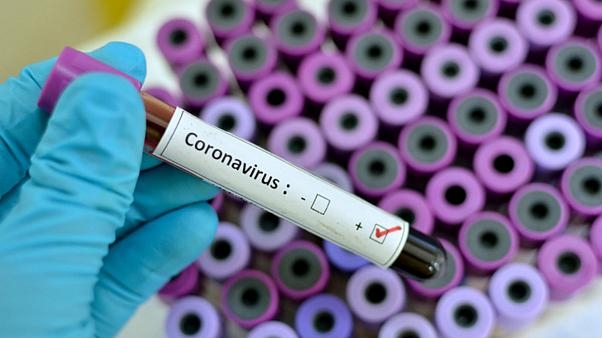 Azərbaycanda daha 78 nəfərdə koronavirus aşkarlandı