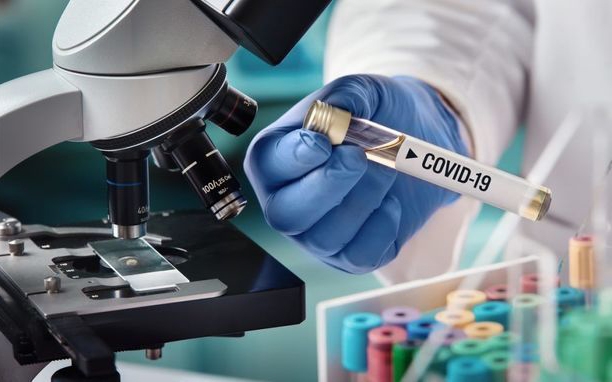 Azərbaycanda 44 753 nəfər koronavirus testindən keçirilib