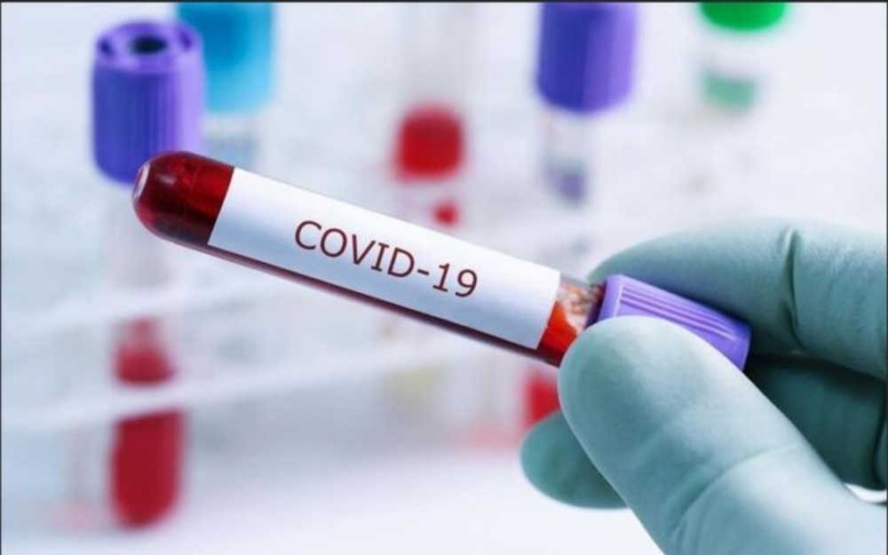 Azərbaycanda COVID-19 testindən 47 mindən çox insan keçib 