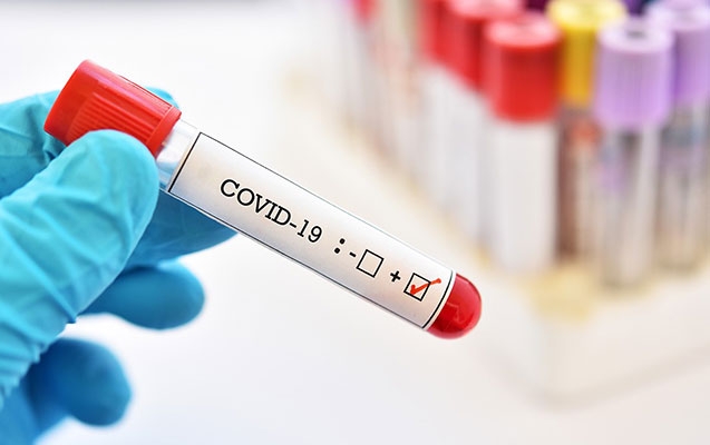 118 nəfər koronavirusa yoluxdu, 87 nəfər sağaldı