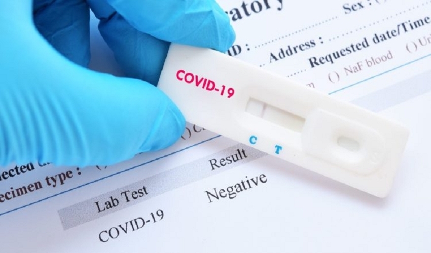 248 nəfər koronavirusa yoluxdu, 101 nəfər sağaldı