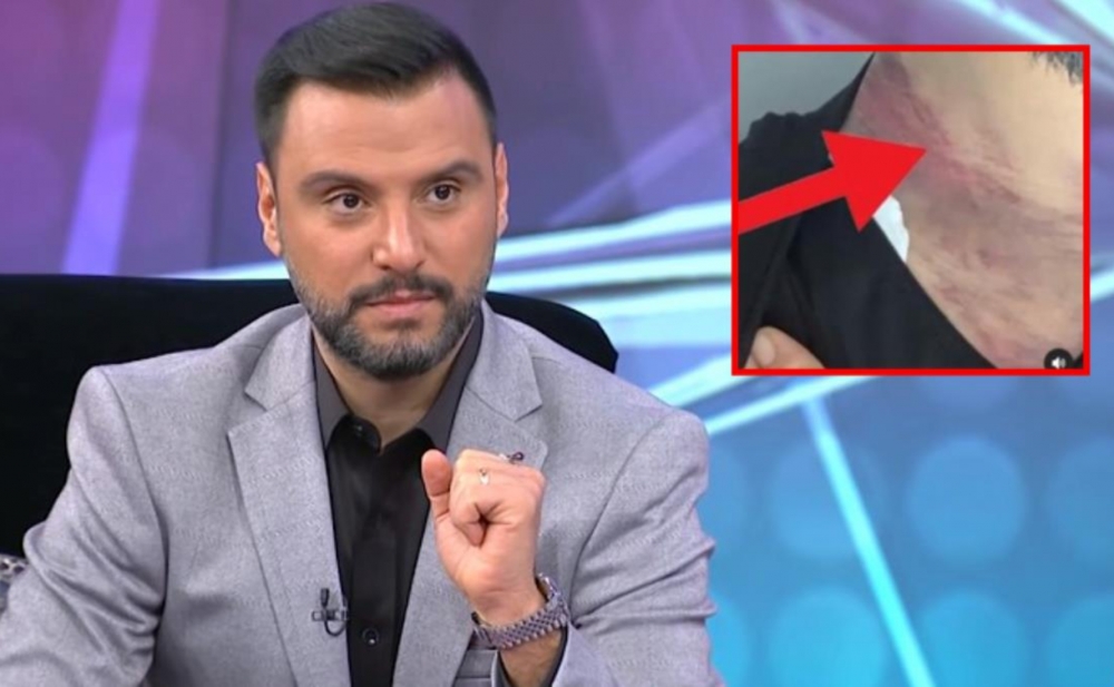 Alişan onu bu hala salan dostunu məhkəməyə verdi - Fotolar