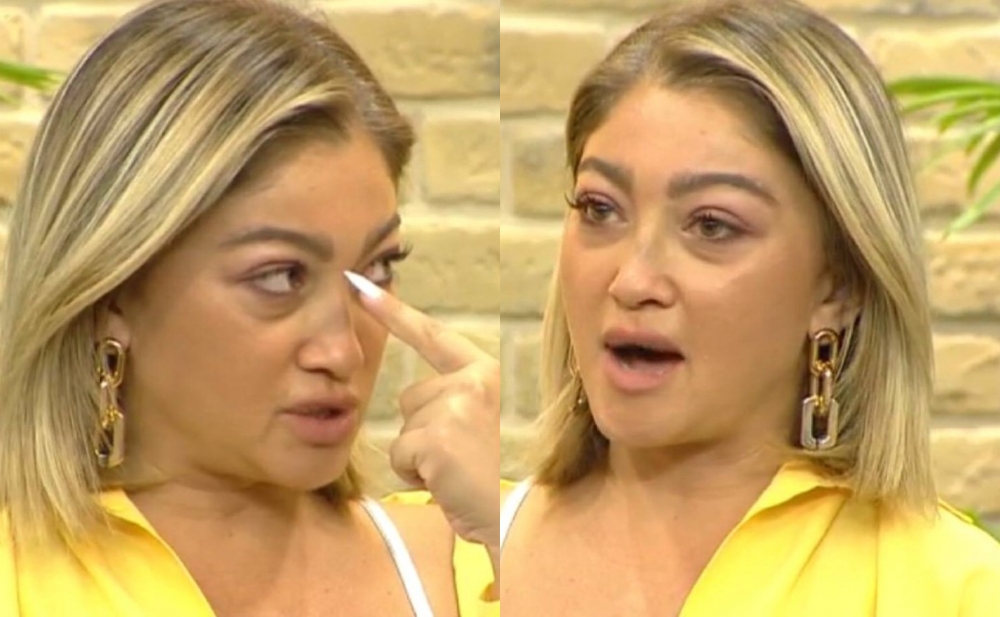 Qəzada Zümrüdün burnu çatlayıb - Fotolar