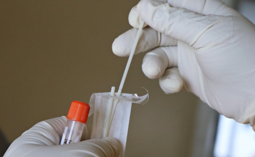 Bu günə olan yoluxma sayı