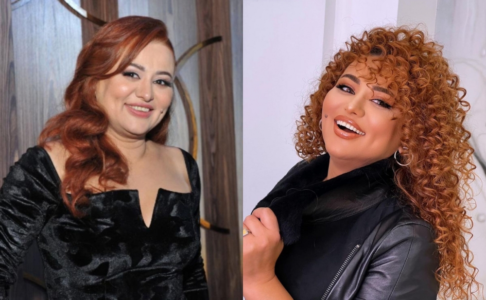 Artıq çəkidən belə xilas olub - Fotolar