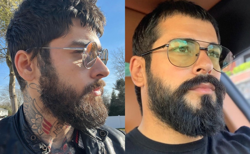 Məşhur müğənnini bu fotosuna görə Burak Özçivitlə səhv saldılar