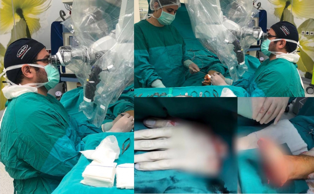 Azərbaycanda ilk dəfə qopan orqan 9 saat sonra əməliyyatla yerinə tikildi - Fotolar