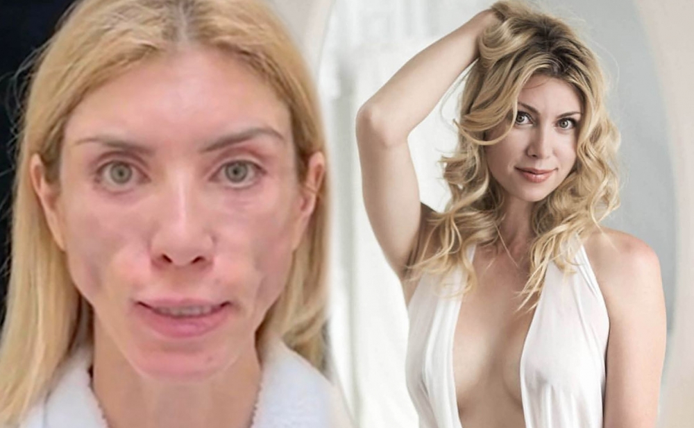 Gözəllik müsabiqəsində ikinci olan model tanınmaz halda - Fotolar