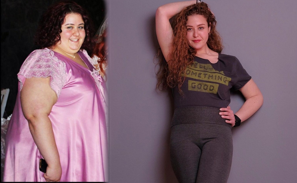 100 kiloqram arıqlayıb belə oldu - Fotolar