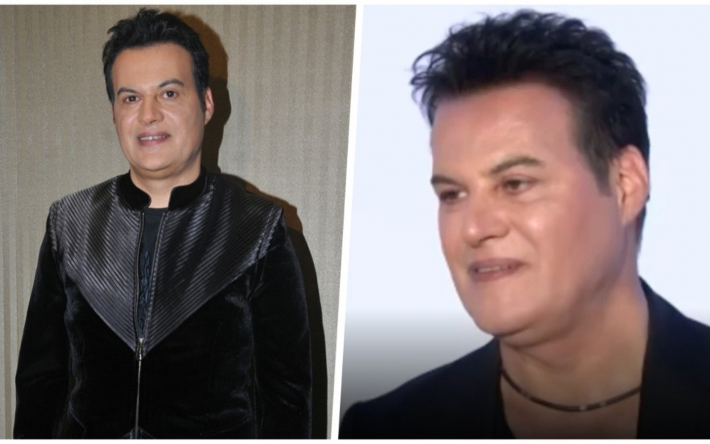 Hakan Pekerdən estetik iddialarına cavab