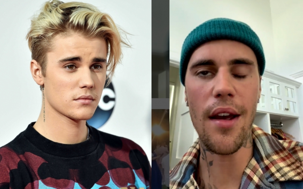 Castin Biber insult keçirtdi - Video