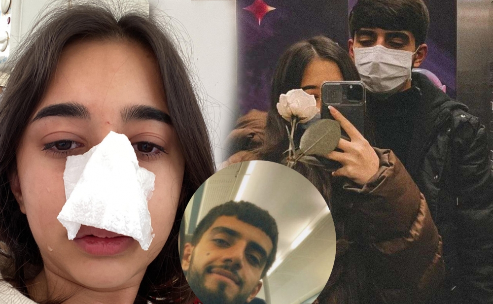 Sevgilisi azərbaycanlı blogeri döyüb - Fotolar
