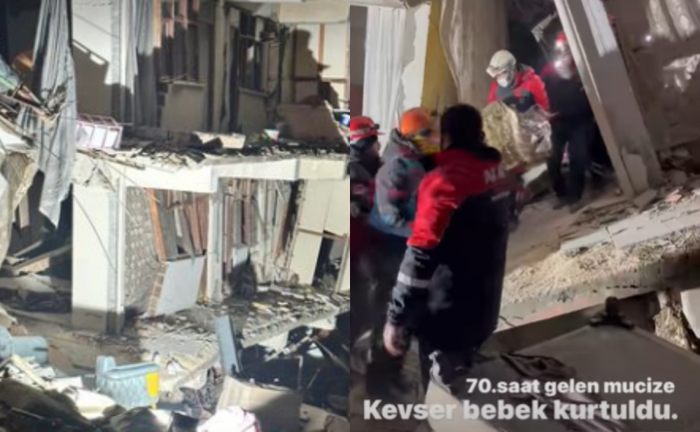 Qardaşı oğluna görə qolunun kəsilməsinə razı oldu - Video