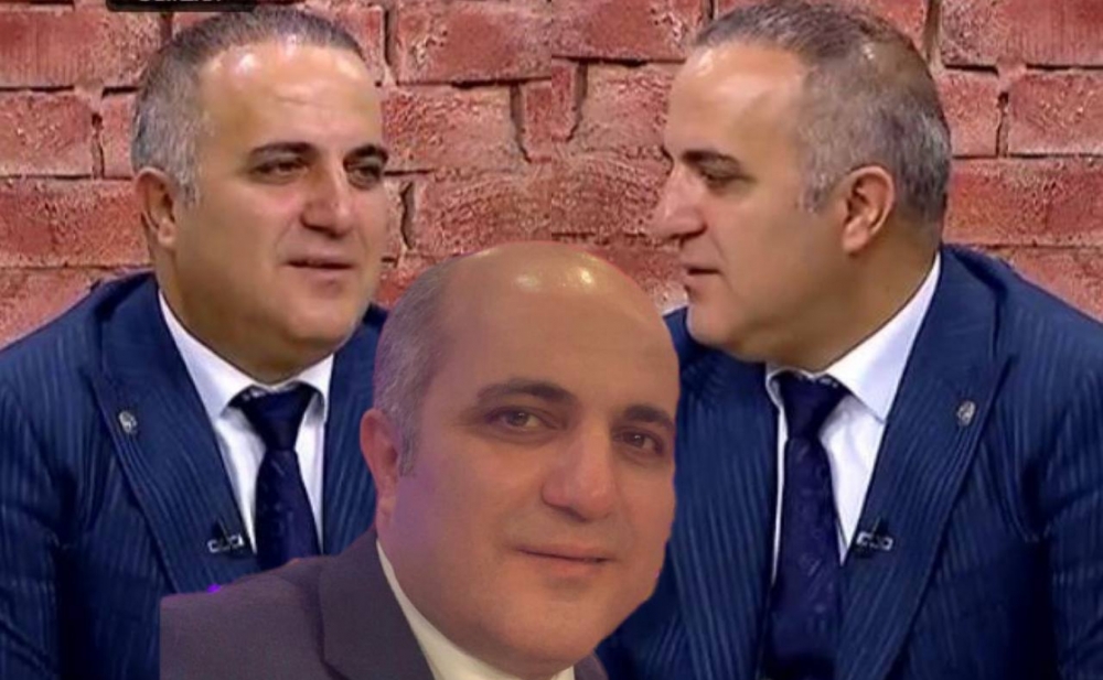 Eldəniz yenidən saç əkdirdi - Fotolar