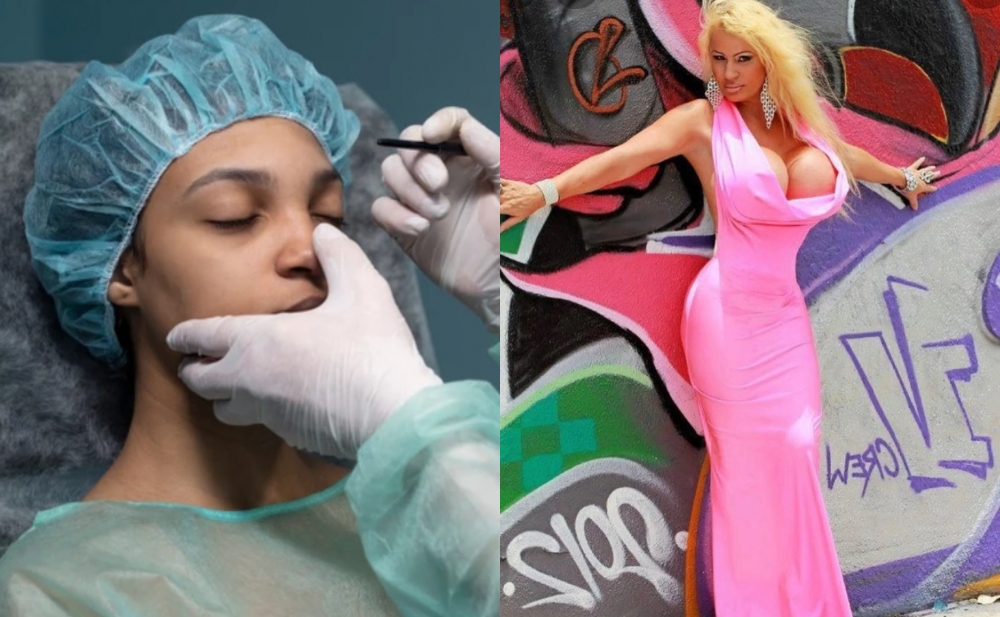 200 dəfə plastik əməliyyat etdirən qadın - Foto