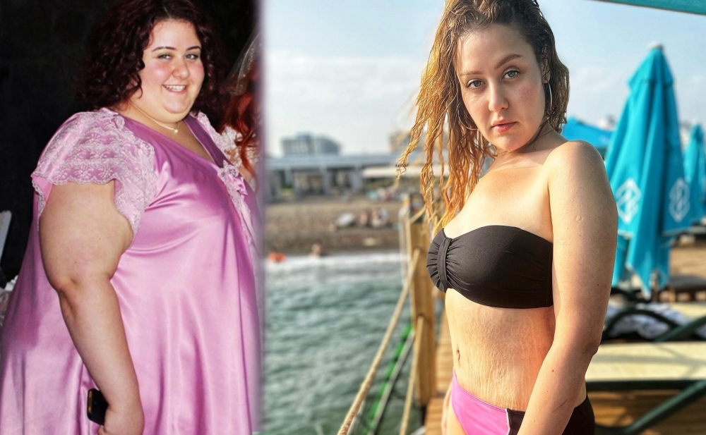 108 kiloqram arıqlayan aktrisanın fotoşopsuz halı - Fotolar