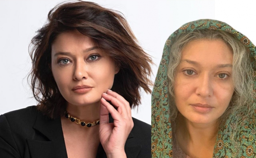 Rüsum artımları Nurgül Yeşilçayı "qocaltdı" - Foto