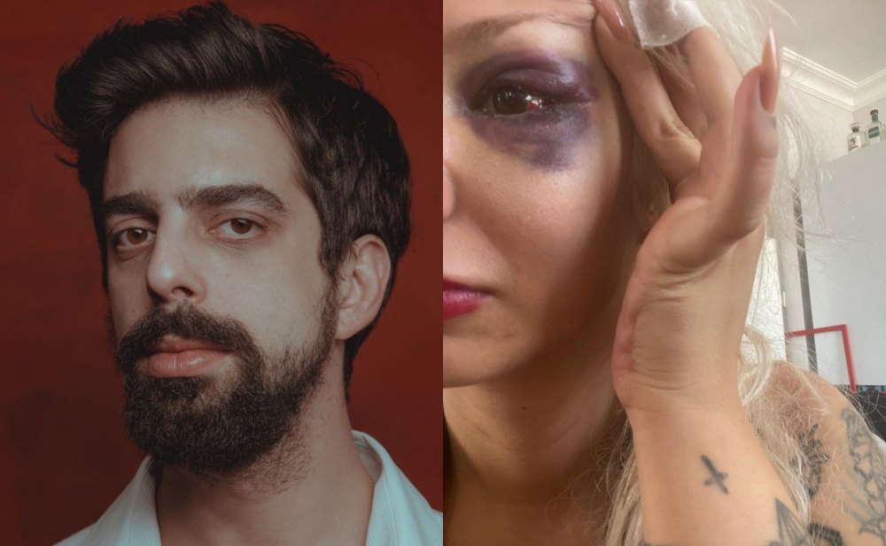 Musiqiçi tərəfindən şiddətə məruz qaldığını dedi - Fotolar